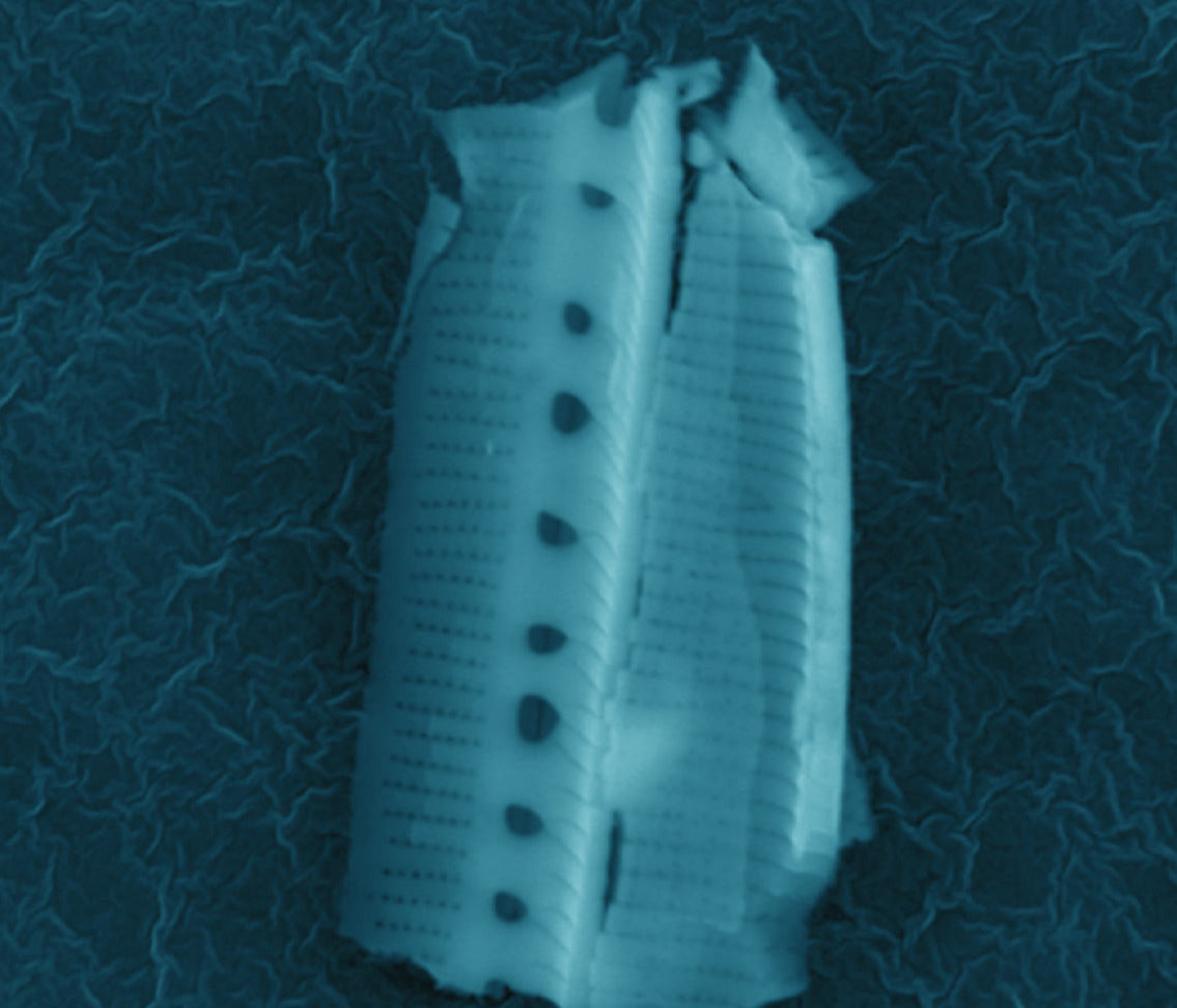 Picture of Diatom